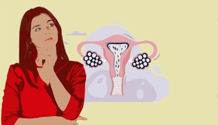 पीसीओएस से हैं परेशान? रोज करें ये योगासन और पाएं आराम