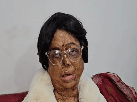 पद्मश्री सम्मान से गदगद एसिड अटैक सर्वाइवर मंगला कपूर बोलीं-पीएम के शब्दों ने हौसला दिया